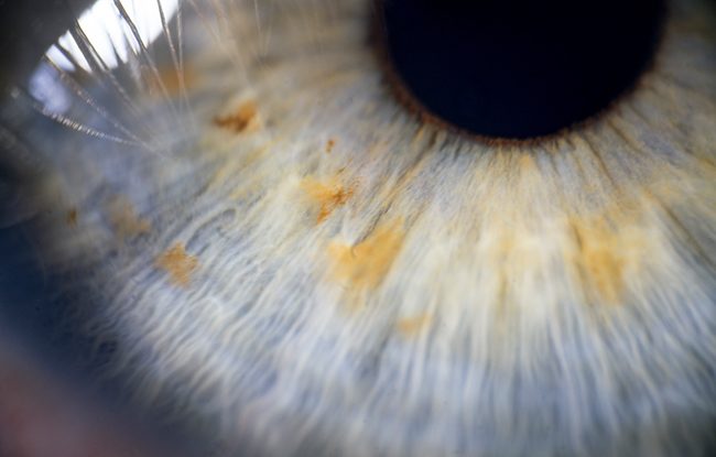 Macro-Photography-Eye-LensRentals-small